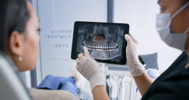 Licensed Dental Implants service in Clovis, CA - Smile Center Dentistry