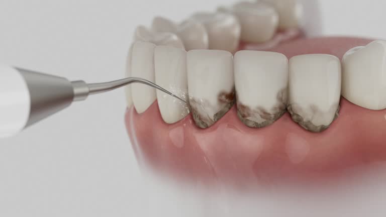 Reliable Dental Implants contractor in Clovis, CA by Smile Center Dentistry